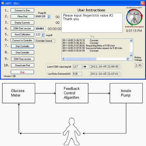 Artificial Pancreas System